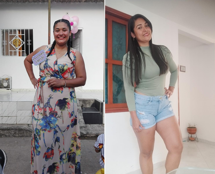 Foto de antes y después del cambio de hábitos alimenticios y control de peso de Sara Mejía, paciente de la Dra. Joyce Almeyda