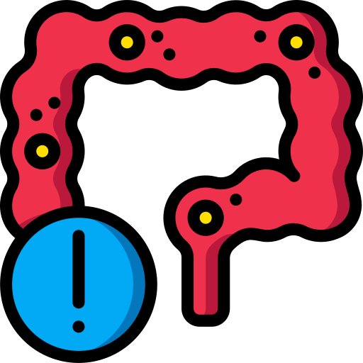 Ilustración de colon inflamado para el tratamiento nutricional de SIBO y colon irritable.
